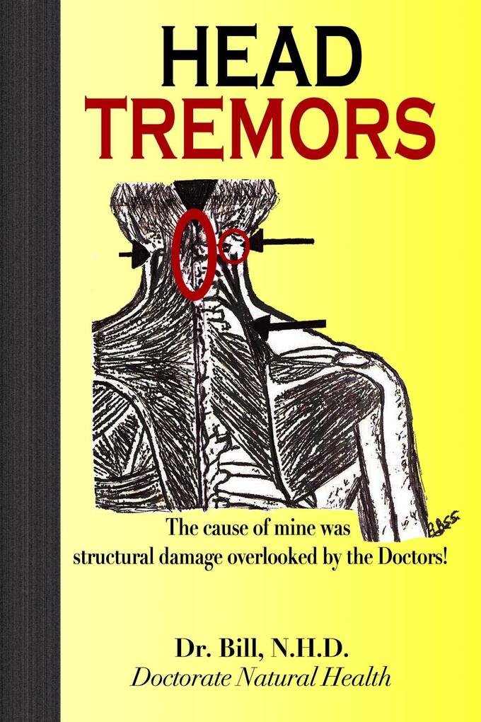 HEAD TREMORS the cause of mine overlooked by Doctors
