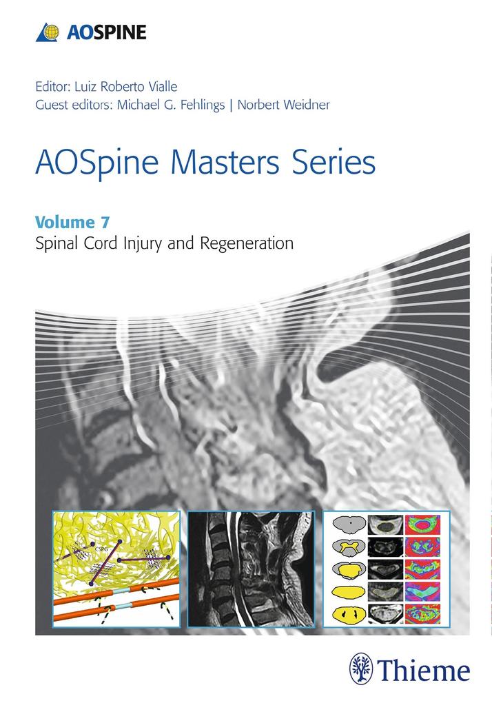 Aospine Masters Series Volume 7: Spinal Cord Injury and Regeneration