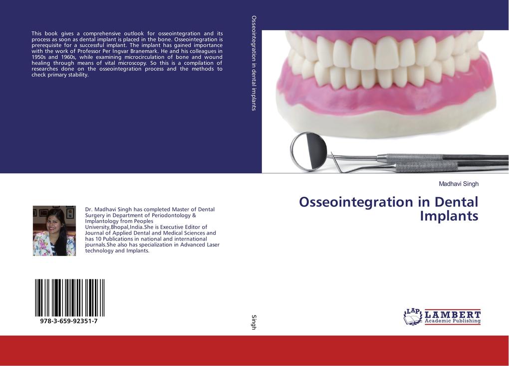Osseointegration in Dental Implants