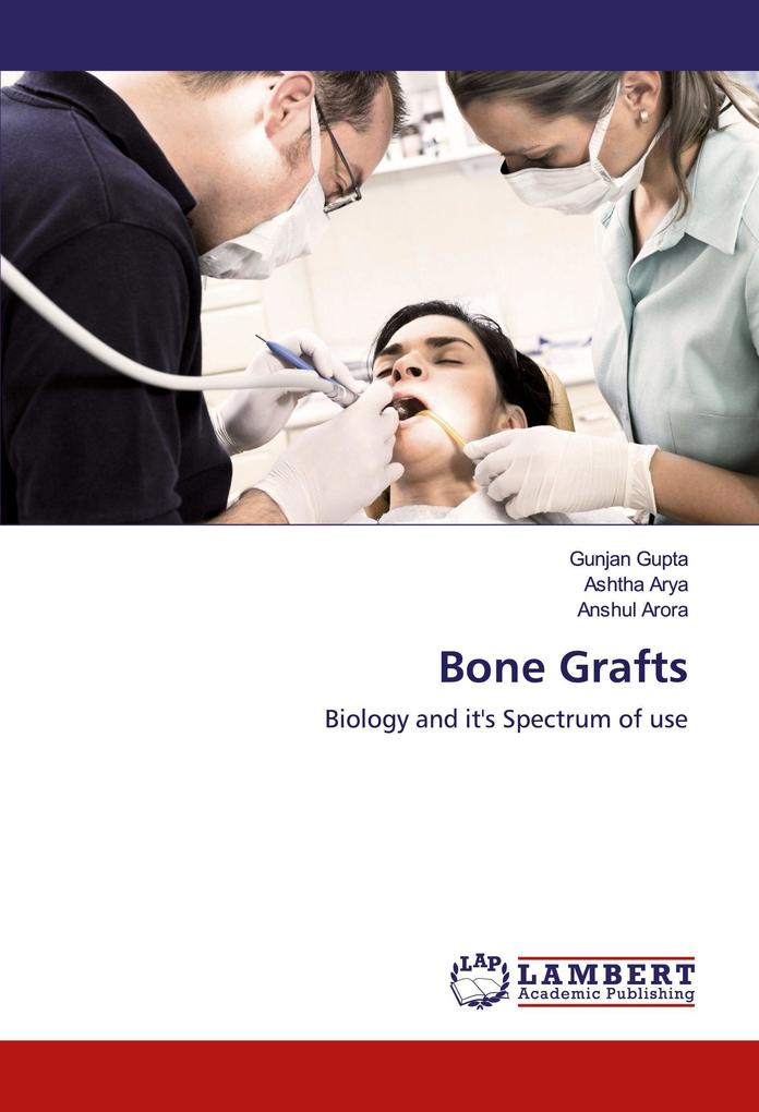 Bone Grafts