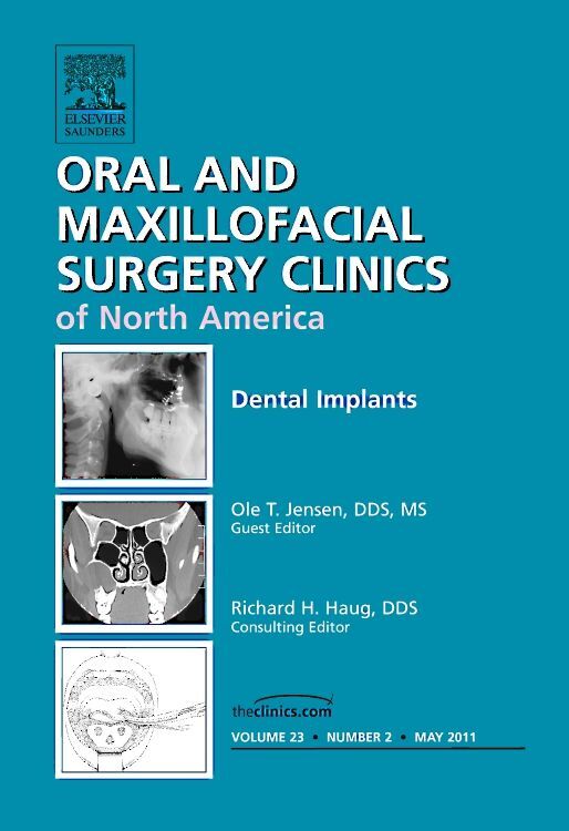 Dental Implants An Issue of Oral and Maxillofacial Surgery Clinics