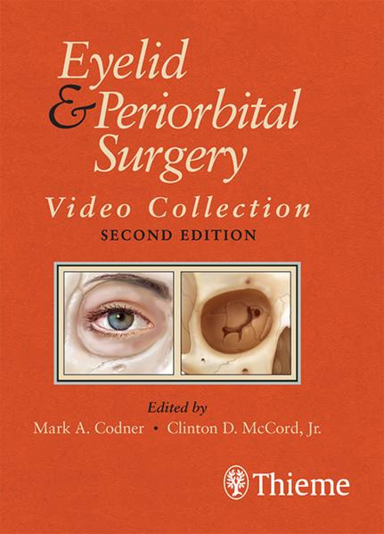 Eyelid and Periorbital Surgery Video Collection. USB-Stick