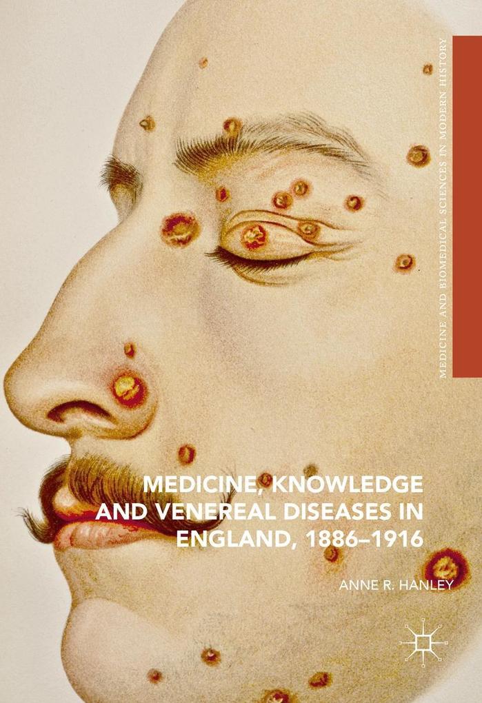 Medicine Knowledge and Venereal Diseases in England 1886-1916
