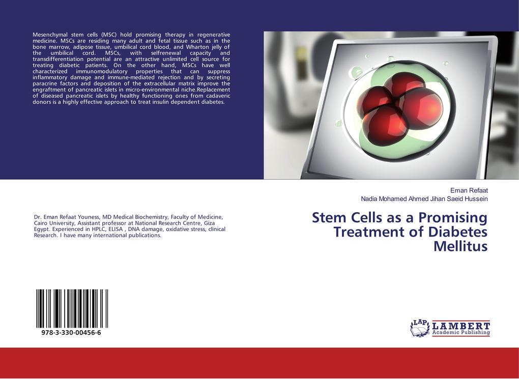 Stem Cells as a Promising Treatment of Diabetes Mellitus
