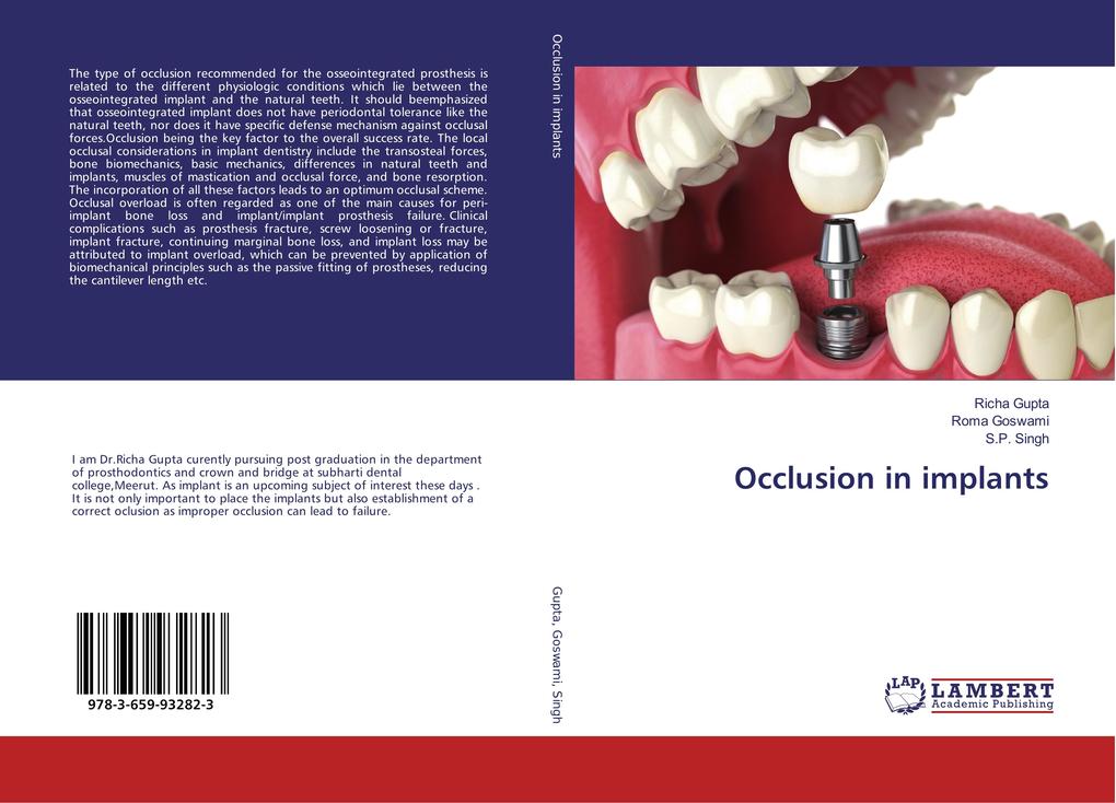 Occlusion in implants