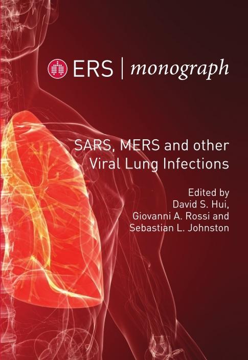 SARS MERS and other Viral Lung Infections
