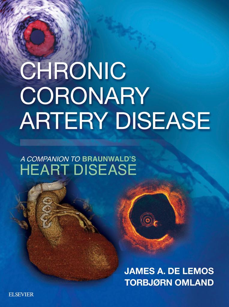 Chronic Coronary Artery Disease: A Companion to Braunwald‘s Heart Disease E-Book