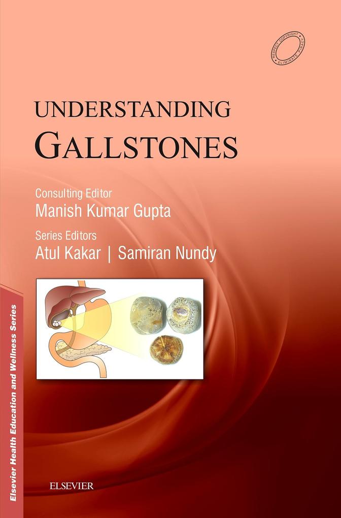 Understanding Gallstones - E-Book
