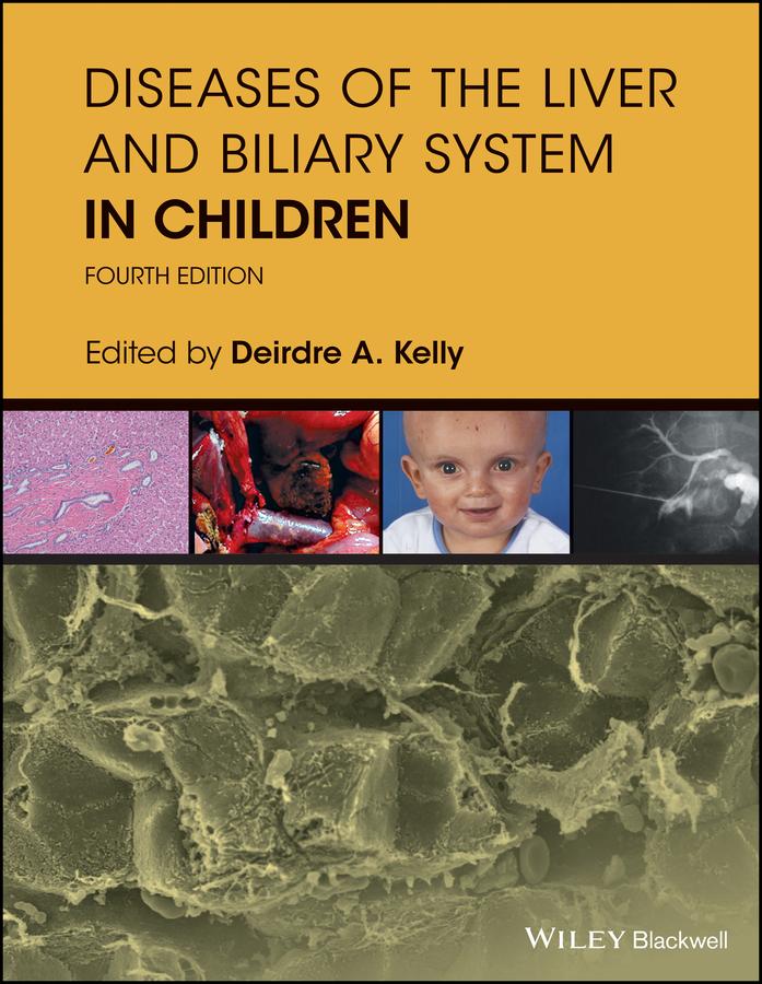 Diseases of the Liver and Biliary System in Children