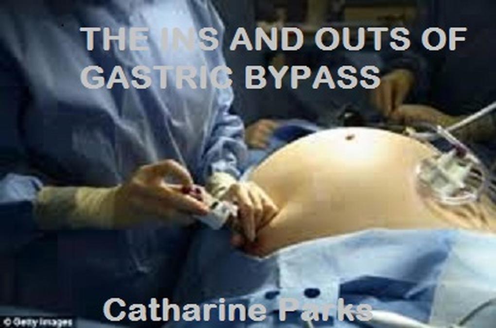 The Ins and Outs of Gastric Bypass