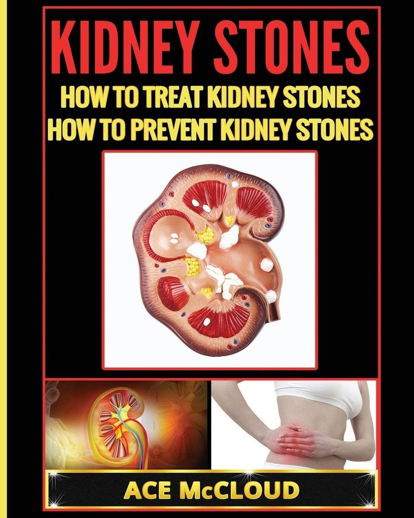 Kidney Stones