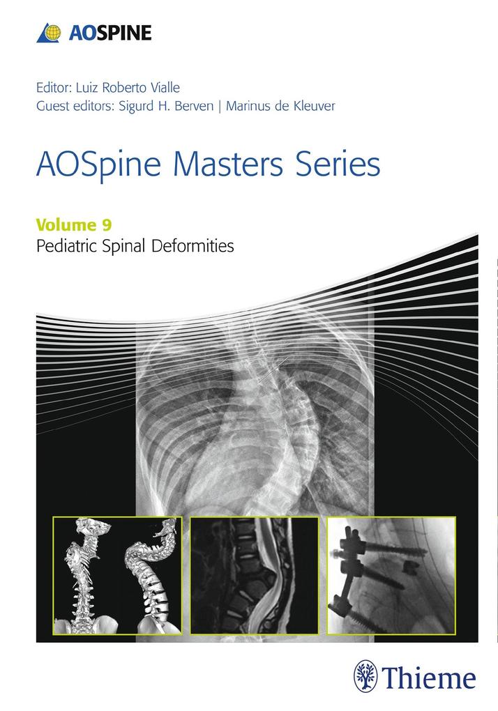 AOSpine Masters Series Volume 9: Pediatric Spinal Deformities