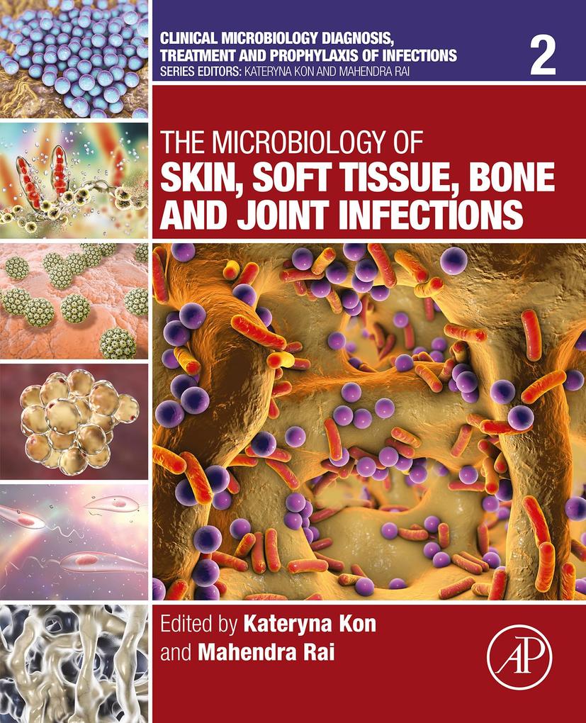 The Microbiology of Skin Soft Tissue Bone and Joint Infections