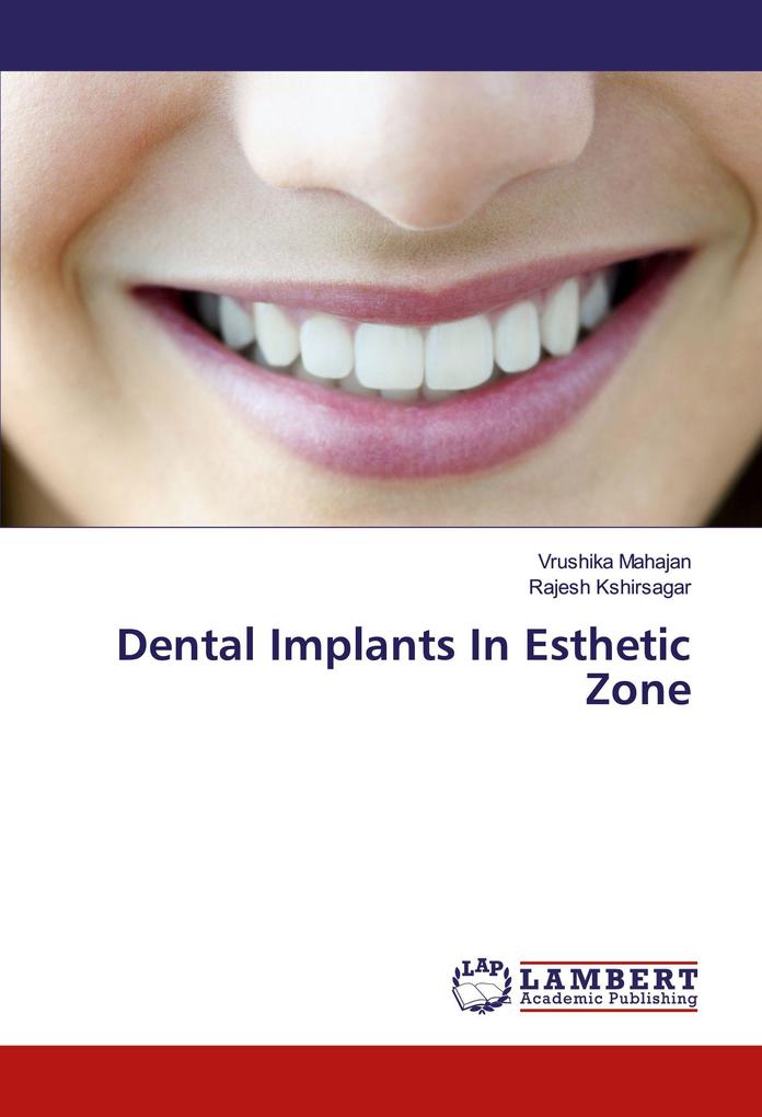 Dental Implants In Esthetic Zone