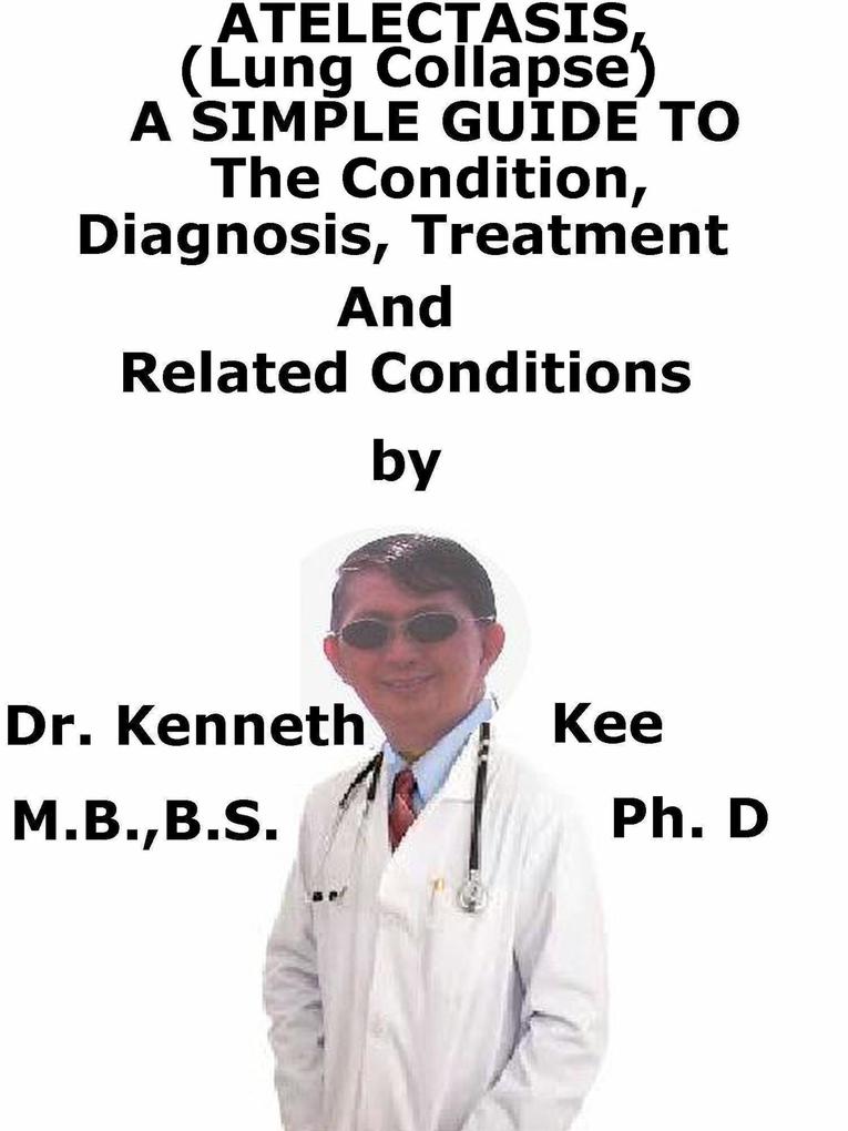 Atelectasis (Lung Collapse) A Simple Guide To The Condition Diagnosis Treatment And Related Diseases