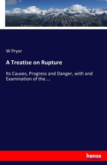 A Treatise on Rupture