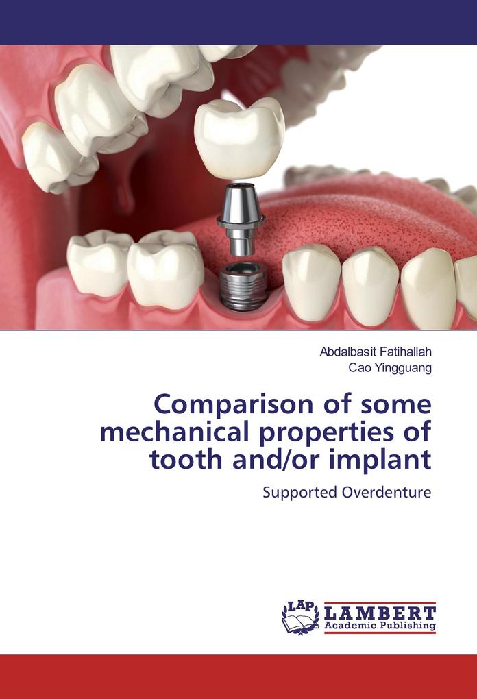 Comparison of some mechanical properties of tooth and/or implant