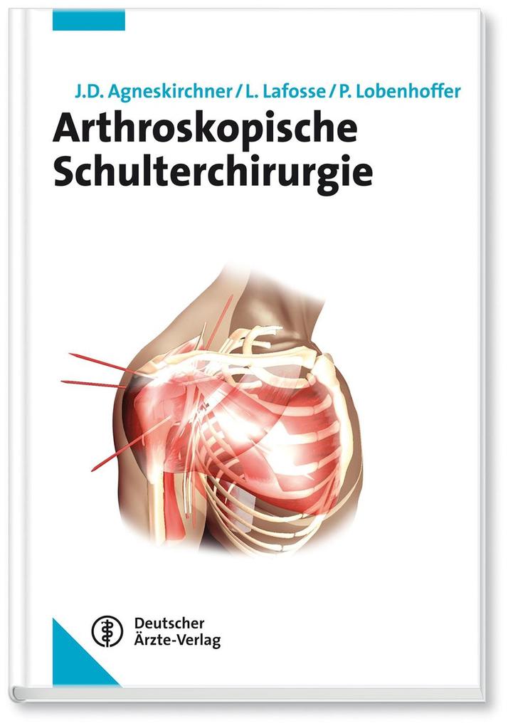 Arthroskopische Schulterchirurgie - Jens D. Agneskirchner/ Laurent Lafosse/ Philipp Lobenhoffer