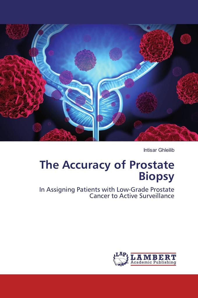 The Accuracy of Prostate Biopsy