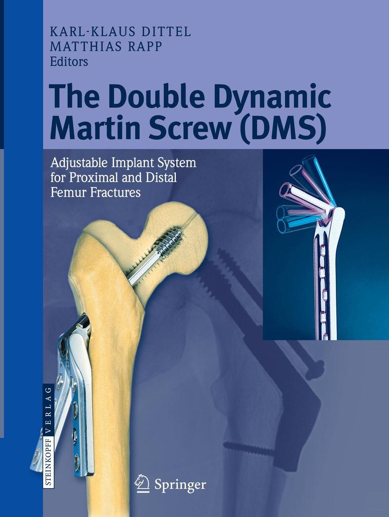 The Double Dynamic Martin Screw (DMS)