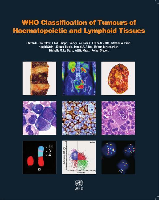 WHO Classification of Tumours of Haematopoietic and Lymphoid Tissues - Who Classification of Tumours Editorial/ E. Campo/ N. L. Harris