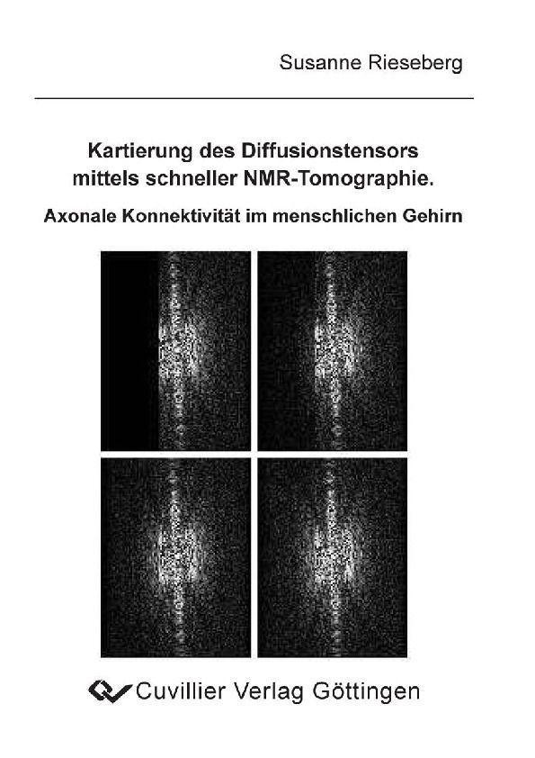Kartierung des Diffusionstensors mittels schneller NMR-Tomographie. Axonale Konnektivität im menschlichen Gehirn