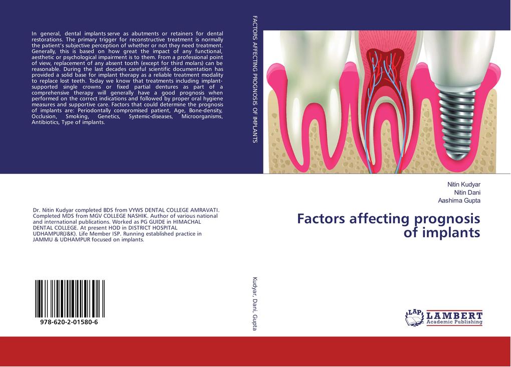 Factors affecting prognosis of implants