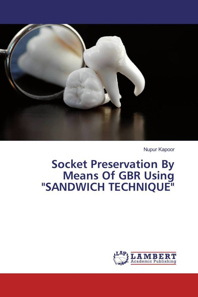 Socket Preservation By Means Of GBR Using 'SANDWICH TECHNIQUE'