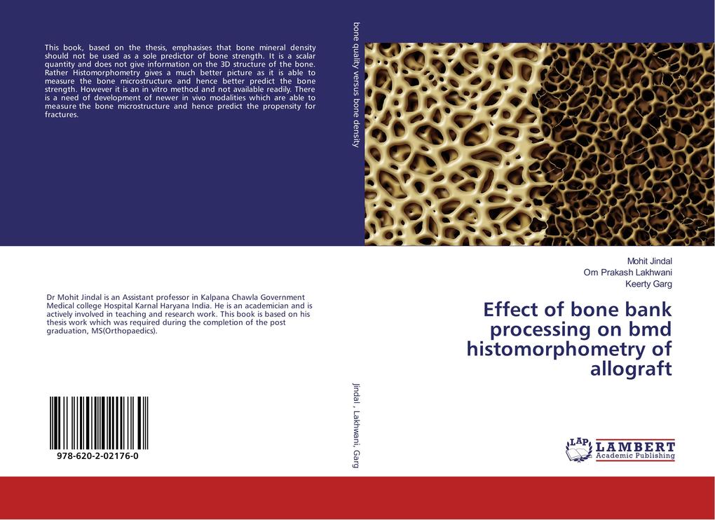 Effect of bone bank processing on bmd histomorphometry of allograft