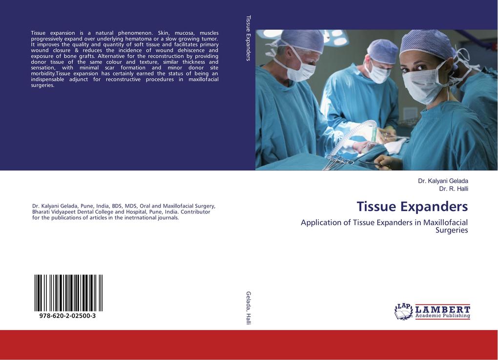 Tissue Expanders