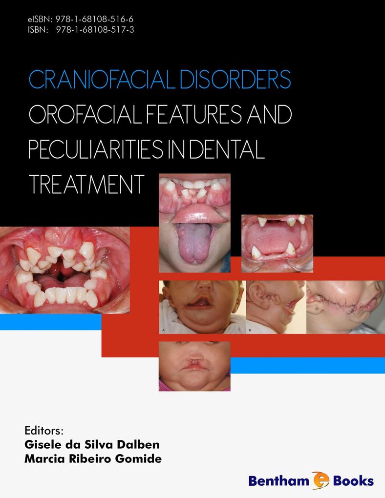Craniofacial Disorders - Orofacial Features and Peculiarities in Dental Treatment