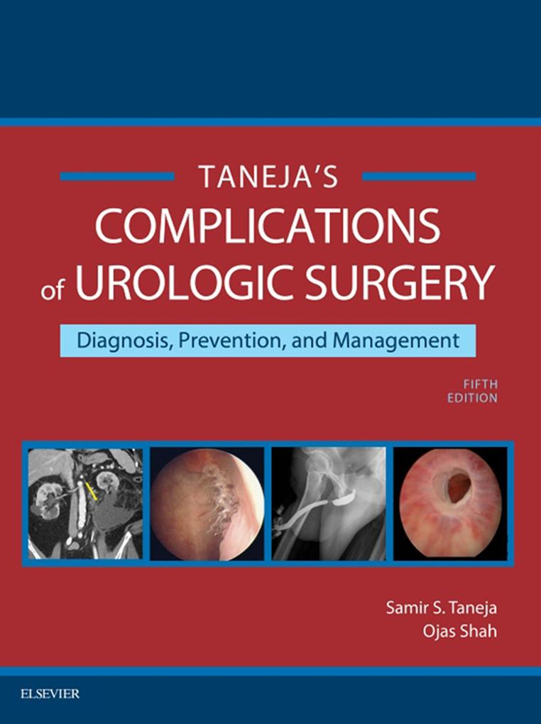 Complications of Urologic Surgery E-Book