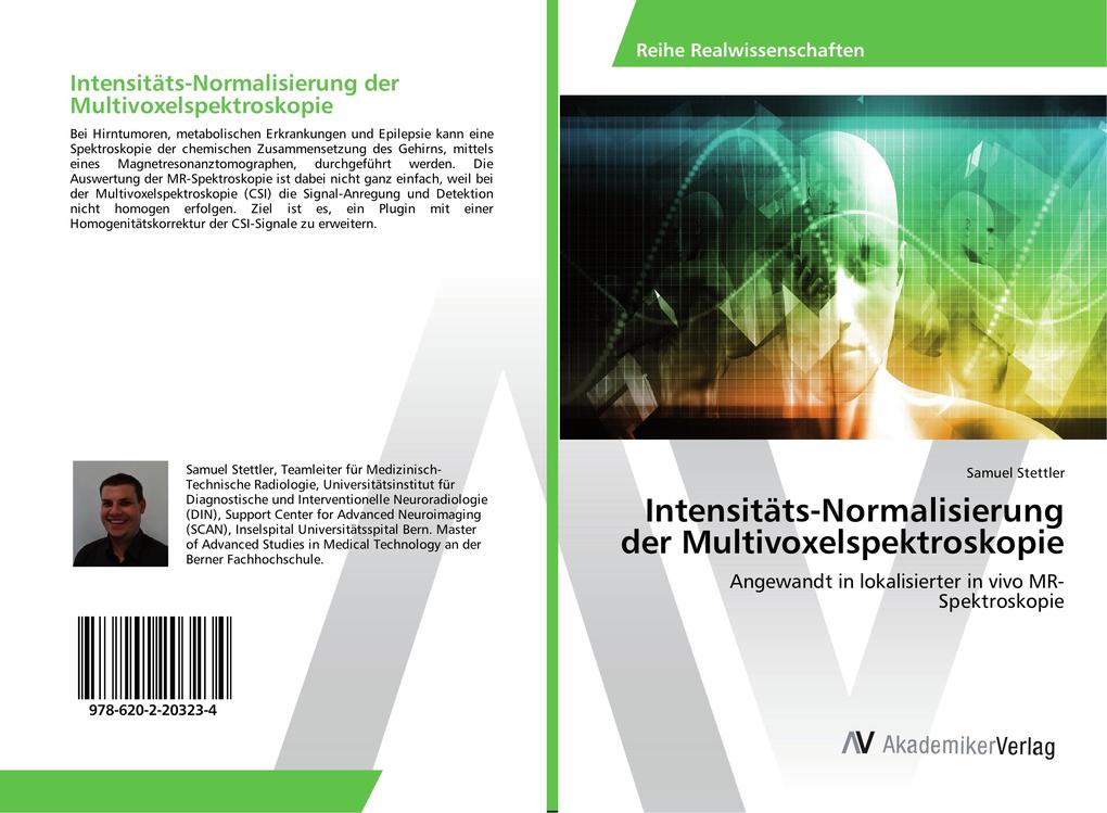Intensitäts-Normalisierung der Multivoxelspektroskopie