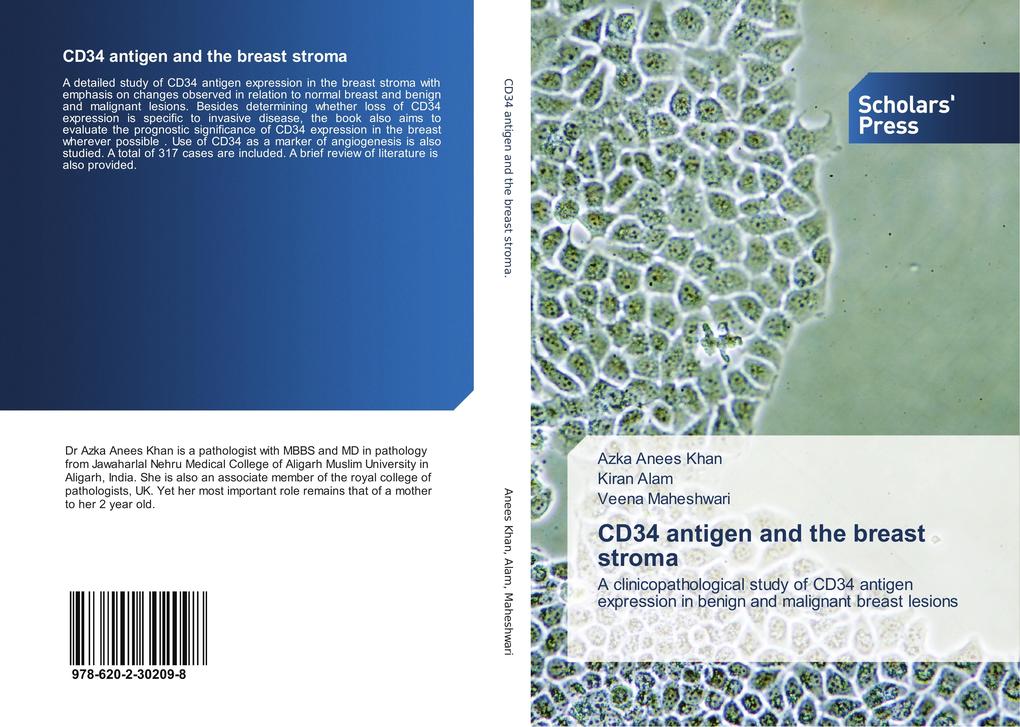 CD34 antigen and the breast stroma