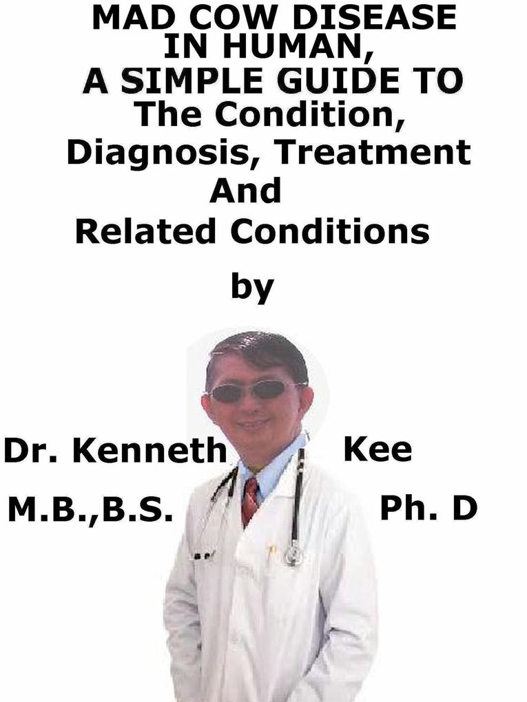 Mad Cow Disease In Humans A Simple Guide To The Condition Diagnosis Treatment And Related Conditions