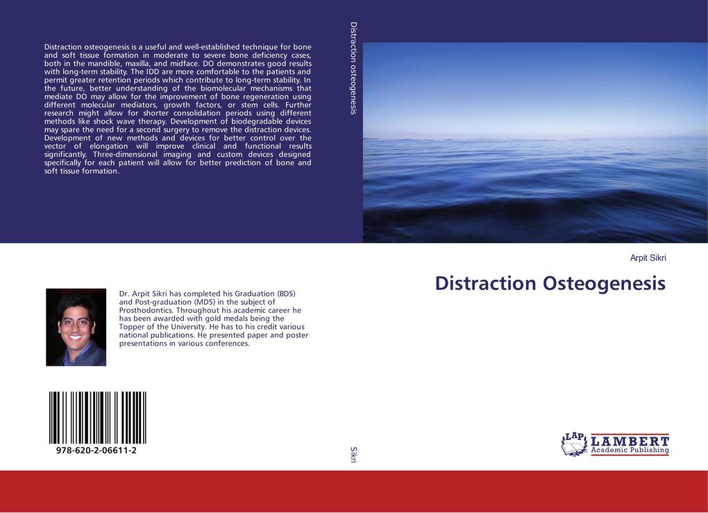Distraction Osteogenesis