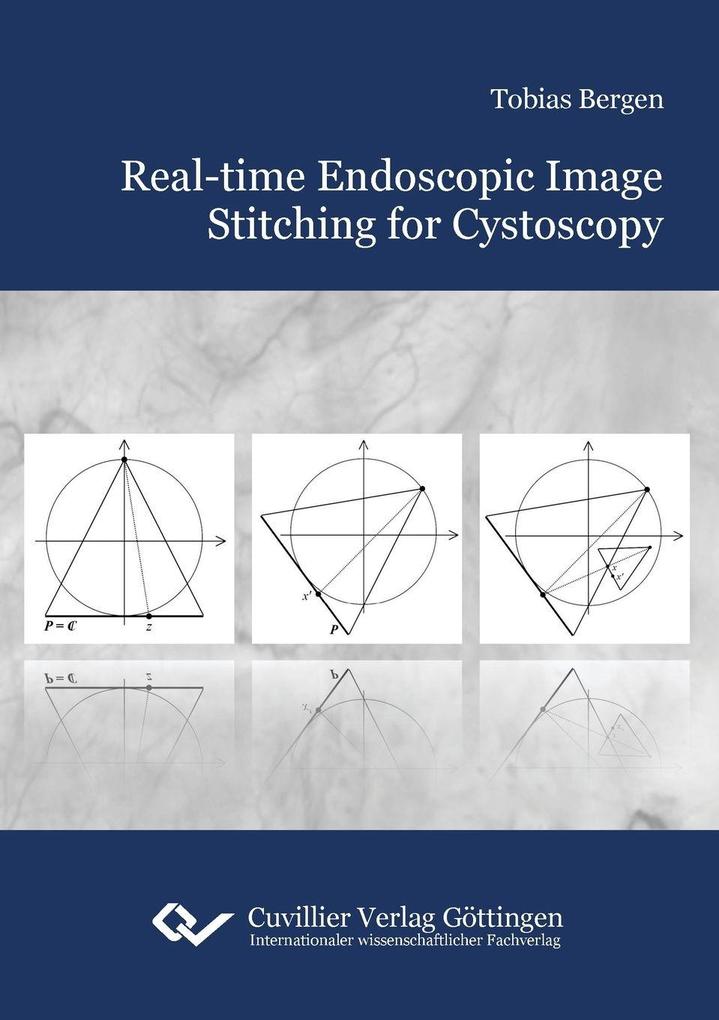Real-time Endoscopic Image Stitching for Cystoscopy