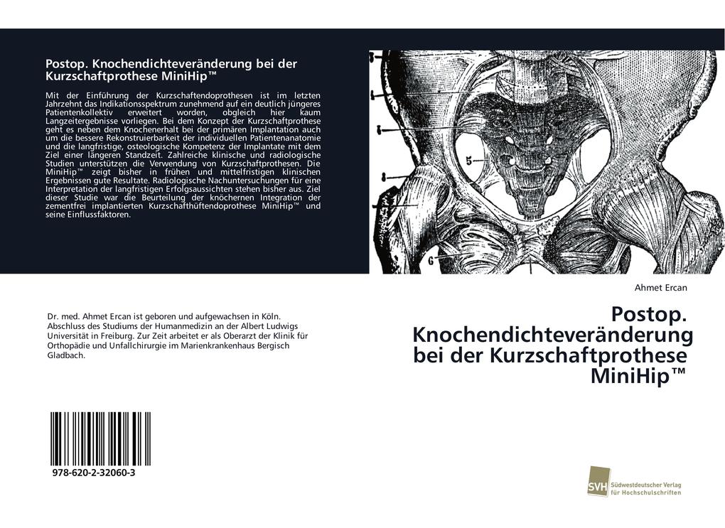 Postop. Knochendichteveränderung bei der Kurzschaftprothese MiniHip(TM)