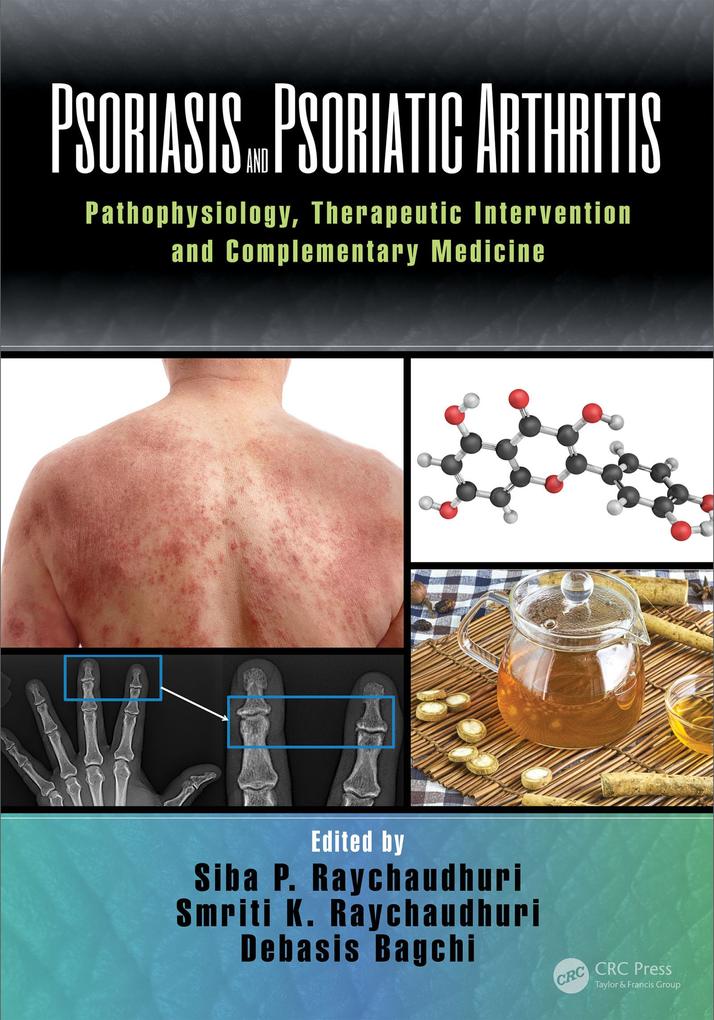 Psoriasis and Psoriatic Arthritis als eBook Download von