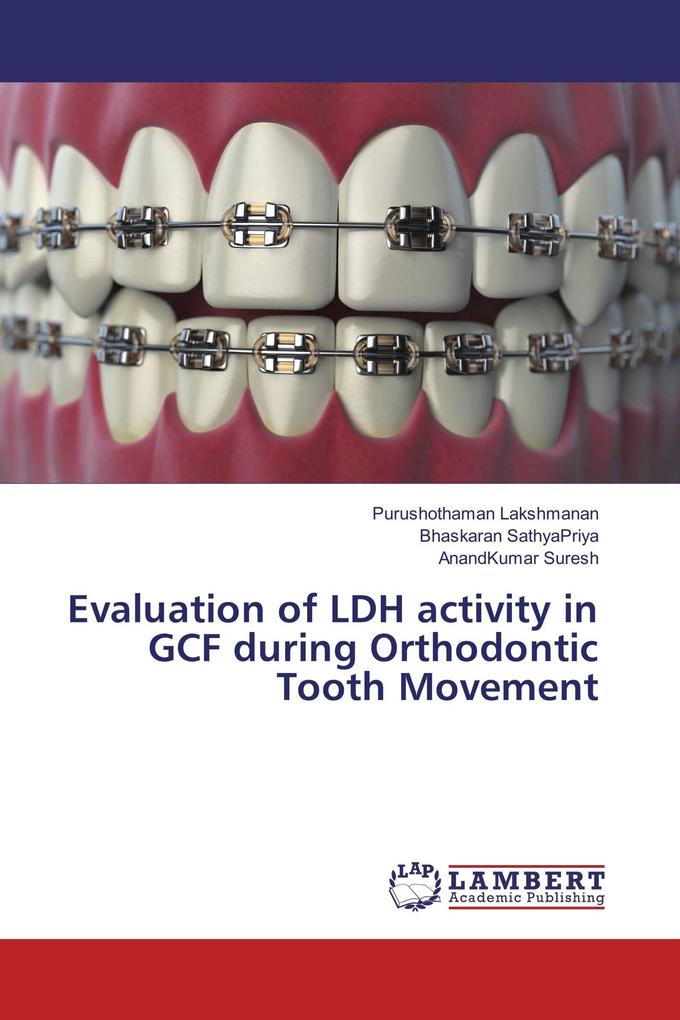 Evaluation of LDH activity in GCF during Orthodontic Tooth Movement
