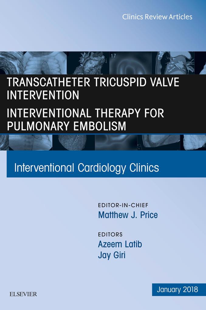 Transcatheter Tricuspid Valve Intervention / Interventional Therapy for Pulmonary Embolism An Issue of Interventional Cardiology Clinics