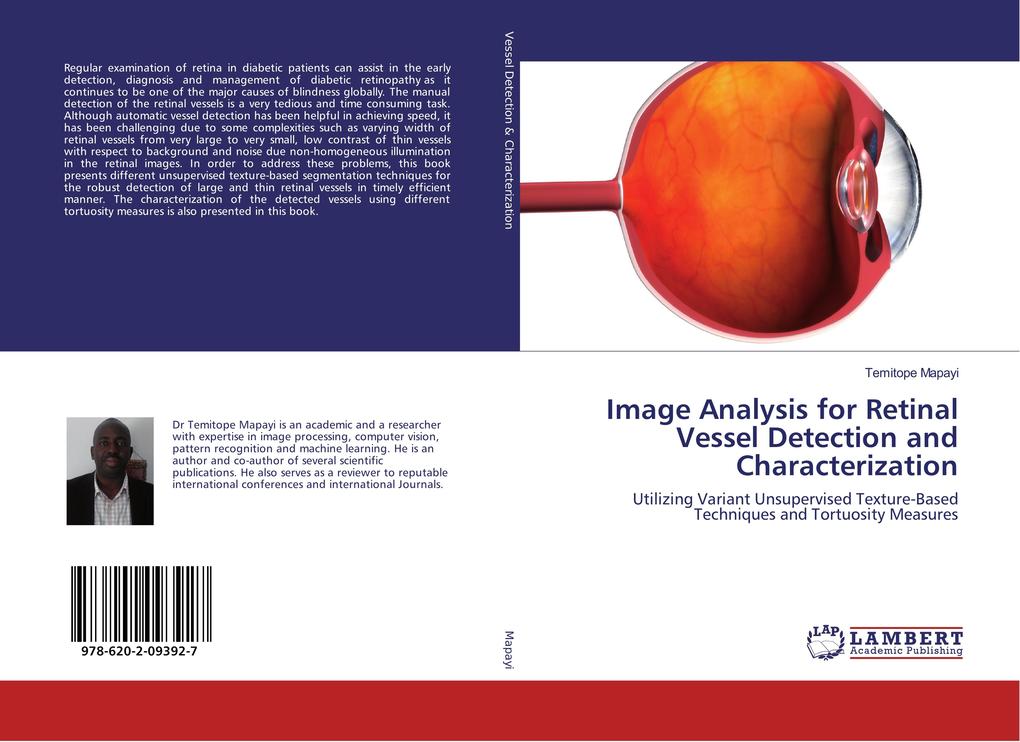 Image Analysis for Retinal Vessel Detection and Characterization