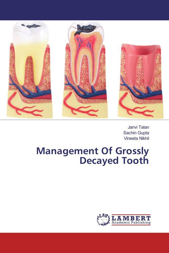 Management Of Grossly Decayed Tooth
