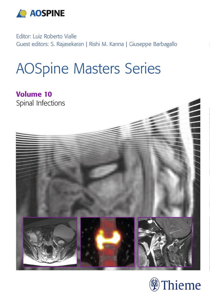 Aospine Masters Series Volume 10: Spinal Infections