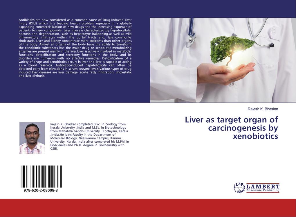 Liver as target organ of carcinogenesis by xenobiotics