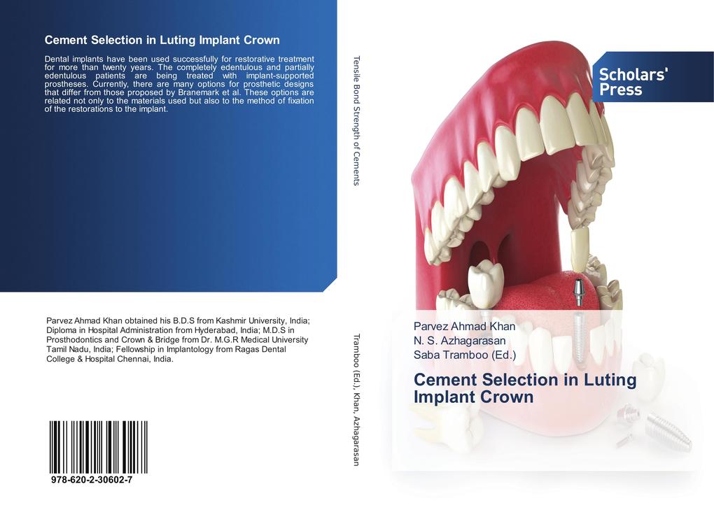 Cement Selection in Luting Implant Crown