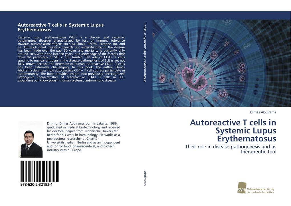 Autoreactive T cells in Systemic Lupus Erythematosus