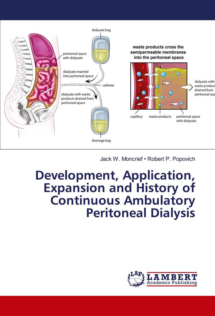 Development Application Expansion and History of Continuous Ambulatory Peritoneal Dialysis
