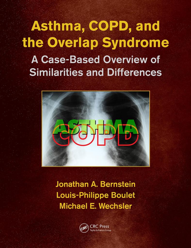 Asthma COPD and Overlap