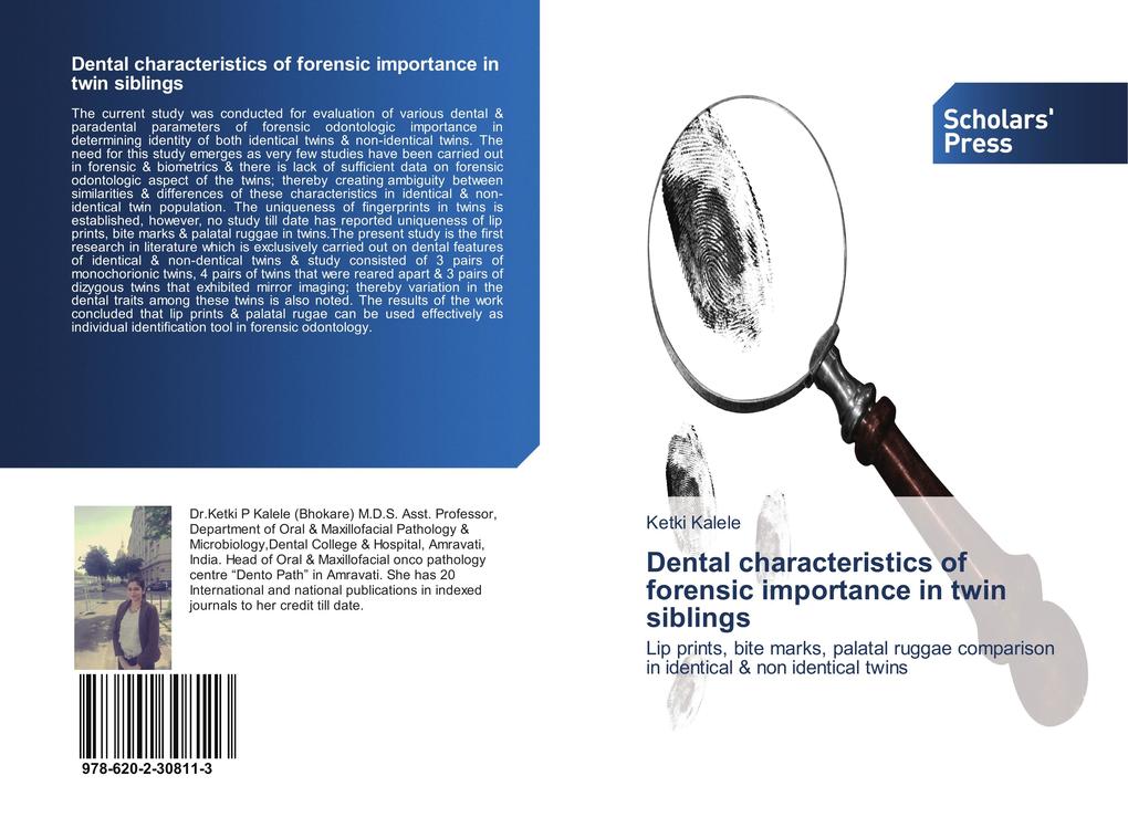 Dental characteristics of forensic importance in twin siblings